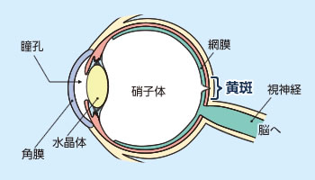 大阪府茨木市、永井眼科の加齢黄斑変性