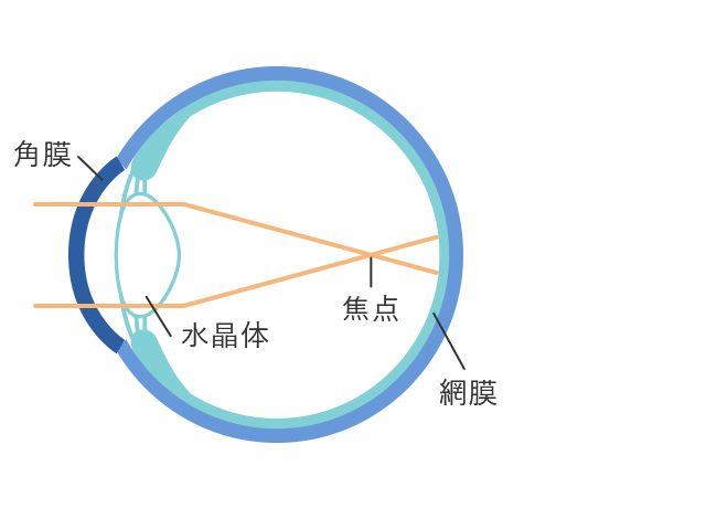 大阪府茨木市の眼科で近視治療